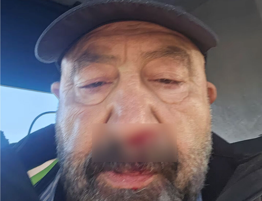 Auckland-busdriver-got-punched-by-a-female-pssenger