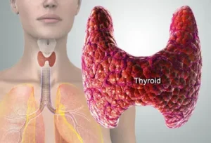 thyroid-symptoms-and-solutions-s2