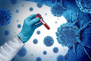 Early-detection-blood-test